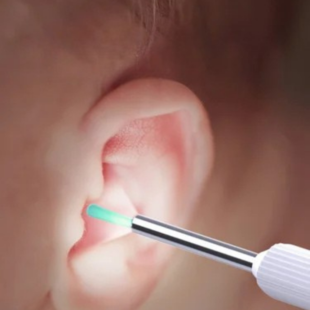Otoscope Oreille - EarVision™ - Blanc