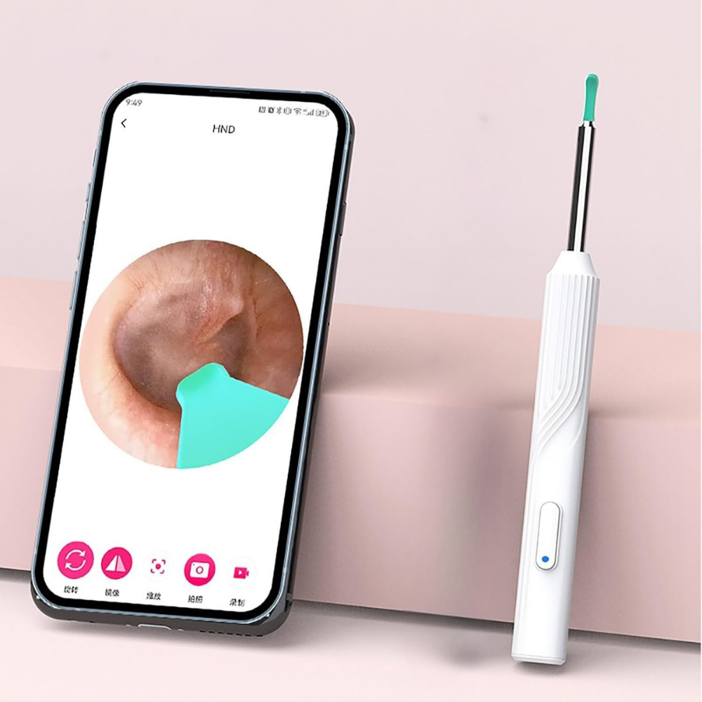 Otoscope Oreille - EarVision™ - Blanc