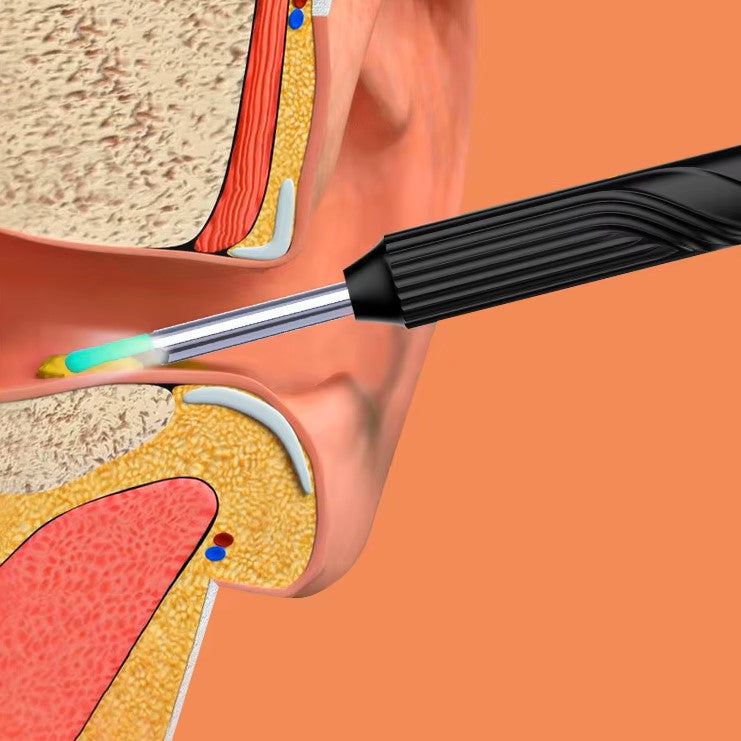 Otoscope Oreille - EarVision™ - Noir